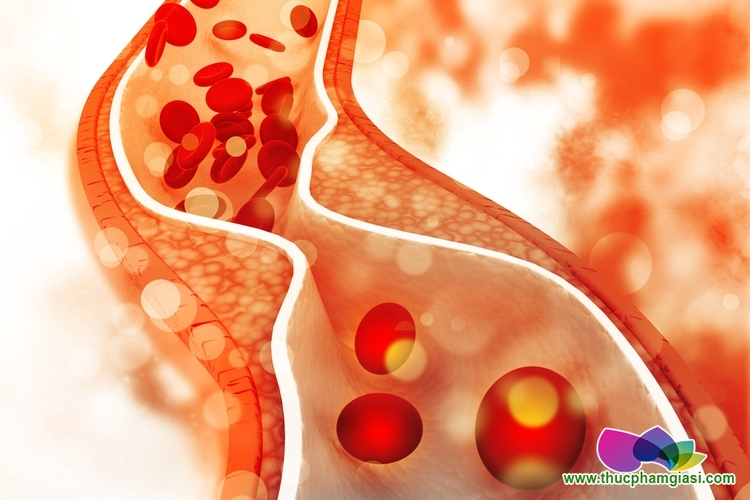 Thịt gà không tốt hơn thịt bò để giảm cholesterol